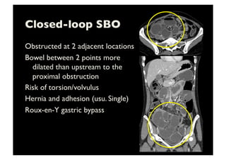 Closed-loop SBO	

Obstructed at 2 adjacent locations 	

Bowel between 2 points more
dilated than upstream to the
proximal obstruction	

Risk of torsion/volvulus	

Hernia and adhesion (usu. Single)	

Roux-en-Y gastric bypass	

 