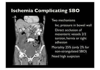 Ischemia Complicating SBO	

Two mechanisms	

	

Inc. pressure in bowel wall	

	

Direct occlusion of
mesenteric vessels 2/2
torsion, hernia or tight
adhesion	

Mortality 25% (only 2% for
non-strangulated SBO)	

Need high suspicion	

 