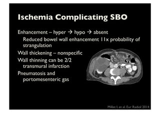 Ischemia Complicating SBO	

Enhancement – hyper ! hypo ! absent	

	

Reduced bowel wall enhancement 11x probability of
strangulation	

Wall thickening – nonspeciﬁc	

Wall thinning can be 2/2
transmural infarction 	

Pneumatosis and
portomesenteric gas 	

Millet I, et al. Eur Radiol 2014	

 