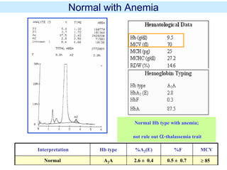 Normal Hb type with anemia;
not rule out α-thalassemia trait
Normal with Anemia
Interpretation Hb type %A2(E) %F MCV
Normal A2A 2.6 ± 0.4 0.5 ± 0.7 ≥ 85
 