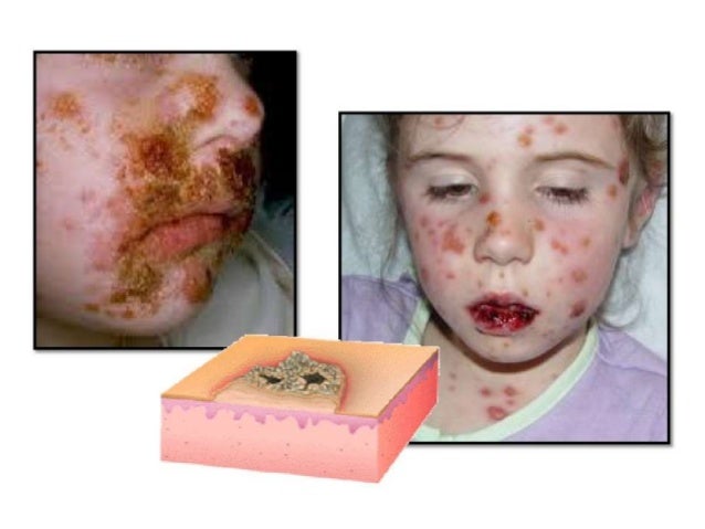 Handout morfologi dan terminologi penyakit kulit(1)