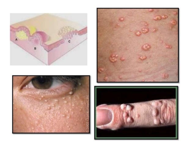 Handout morfologi dan terminologi penyakit kulit(1)