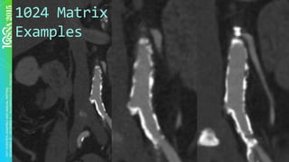 1024	Matrix	
Examples	
 