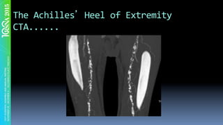 The	Achilles 	Heel	of	Extremity	
CTA......	
 