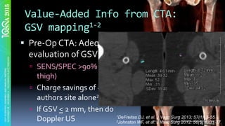 Value-Added	Info	from	CTA:		
GSV	mapping1-2	
§  Pre-Op	CTA:	Adequate	for	
evaluation	of	GSV	size1-2	
ú  SENS/SPEC	>90%	(better	in	
thigh)	
ú  Charge	savings	of	~	50K	at	
authors	site	alone2	
ú  If	GSV	<	2	mm,	then	do	
Doppler	US	 1DeFreitas DJ, et al. J Vasc Surg 2013; 57(1): 5-55.
2Johnston WF, et al. J Vasc Surg 2012: 56(5) 1331-37.
 