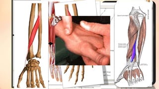 MY ARCHES NAME OF THE HAND 
Red: one of the oblique arches 
IS 
WHAAAAT??!! 
Brown: one of the longitudinal arches of the digits 
Dark green: transverse carpal arch 
Light green: transverse metacarpal arch 
 