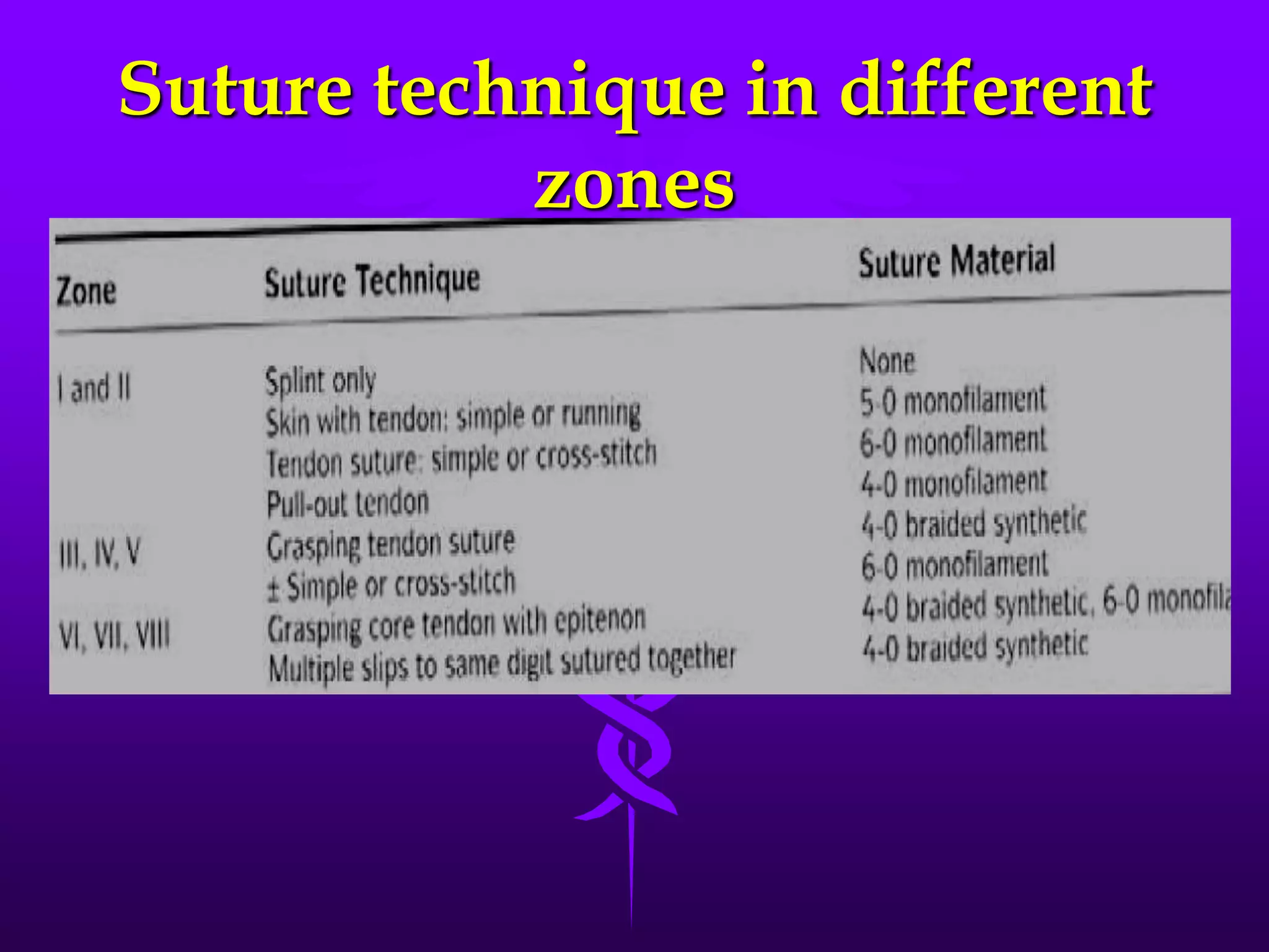 Suture technique in different
zones
 
