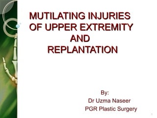 MUTILATING INJURIESMUTILATING INJURIES
OF UPPER EXTREMITYOF UPPER EXTREMITY
ANDAND
REPLANTATIONREPLANTATION
By:
Dr Uzma Naseer
PGR Plastic Surgery
1
 