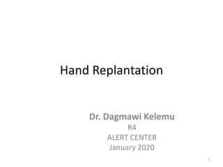 Hand Replantation
Dr. Dagmawi Kelemu
R4
ALERT CENTER
January 2020
1
 