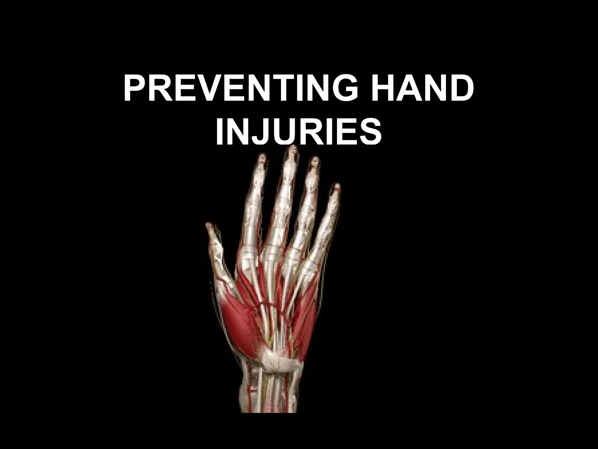 Prevent Hand Importance of hand safety Safety ur hand | PPT