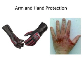 Arm and Hand Protection
 