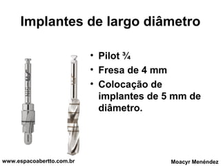 Implantes de largo diâmetro
• Pilot ¾
• Fresa de 4 mm
• Colocação de
implantes de 5 mm de
diâmetro.

www.espacoabertto.com.br

Moacyr Menéndez

 