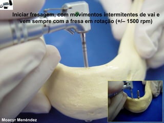 Iniciar fresagem, com movimentos intermitentes de vai e
vem sempre com a fresa em rotação (+/– 1500 rpm)

Moacyr Menéndez

 