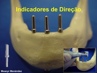Indicadores de Direção

Moacyr Menéndez

 