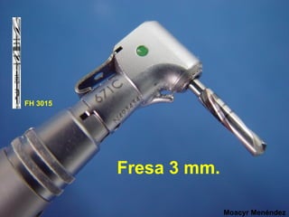 FH 3015

Fresa 3 mm.
Moacyr Menéndez

 