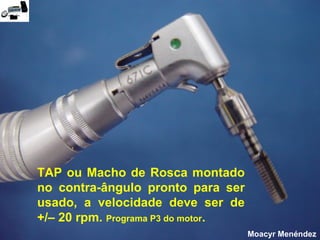 TAP ou Macho de Rosca montado
no contra-ângulo pronto para ser
usado, a velocidade deve ser de
+/– 20 rpm. Programa P3 do motor.
Moacyr Menéndez

 