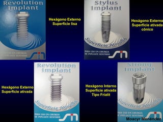 Hexágono Externo
Superfície lisa

Hexágono Externo
Superfície ativada

Hexágono Externo
Superfície ativada
cônico

Hexágono Interno
Superfície ativada
Tipo Frialit

Moacyr Menéndez

 