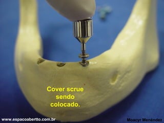 Cover scrue
sendo
colocado.
www.espacoabertto.com.br

Moacyr Menéndez

 