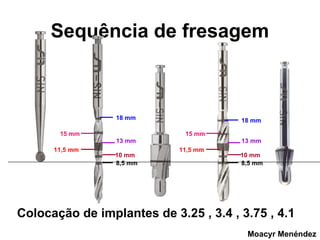 Sequência de fresagem

18 mm
15 mm

18 mm
15 mm

13 mm
11,5 mm

10 mm
8,5 mm

13 mm
11,5 mm

10 mm
8,5 mm

Colocação de implantes de 3.25 , 3.4 , 3.75 , 4.1
Moacyr Menéndez

 