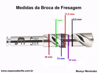 Medidas da Broca de Fresagem
11,5 mm
15 mm

18 mm

www.espacoabertto.com.br

13 mm

8,5 mm

10 mm

Moacyr Menéndez

 