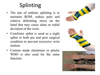 Hand splinting in common orthopedic & neurological condition 1 | PPTX