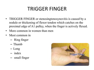 Hand splinting in common orthopedic & neurological condition 1 | PPTX
