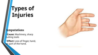 Hand Injuries Types Hands Safety Awareness presentation .pptx