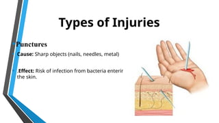 Sharp Object Hand Injury Hands Safety Awareness presentation .pptx