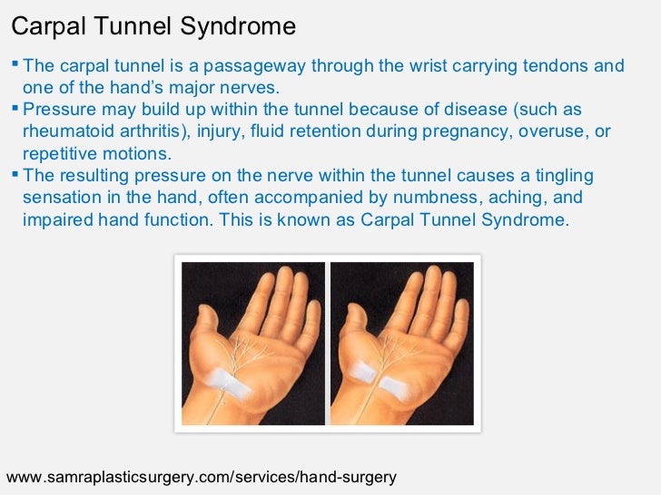 Hand Surgery NJ Plastic Surgeon