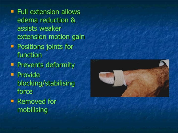 Hand Therapy Stiff Small Joints Of The Fingers