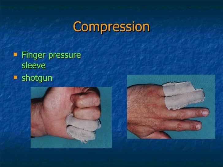 Hand Therapy Stiff Small Joints Of The Fingers