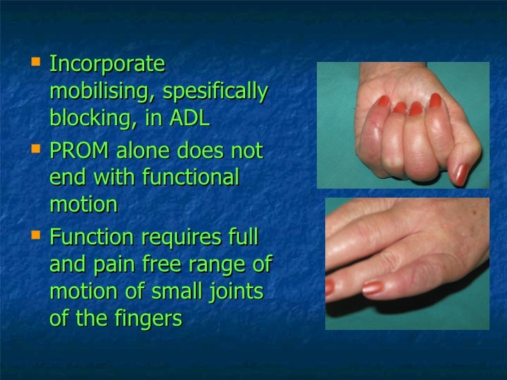 Hand Therapy Stiff Small Joints Of The Fingers