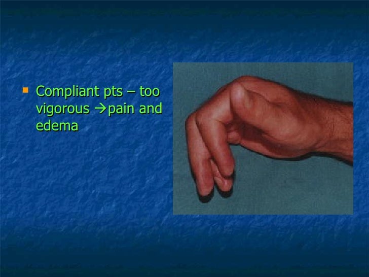 Hand Therapy Stiff Small Joints Of The Fingers