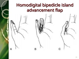 HandTrauma-1_0(1) at manufacturing company.ppt