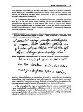 R
H
Y
T
H
MAND FORM QUALITY 71
Drugdetection in handwriting is complicated by its similarity to nervous problems.
Minor tranquilizer users have difficulty writing on a level line and keeping even
spacing and letter size; mistakes occur, particularly in halts or breaks in the con-
necting strokes along the baseline.
The stronger anti-depressants and mood-changing drugs cause tiny uncontrol-
lable jerks of the hand. These produce sudden and obvious mistakes and weirdly-
shaped letters. The pressure is very uneven, slant varies at random, and angular
shapes thrust suddenly next to rounded ones. Letters rise and fall unexpectedly.
Overall the rhythm pattern shows evenness punctuated by abrupt and noticeably
bizarre tremors and mistakes.
MINOR TRANQUILIZERS.UncontrollableJerksof the hand cause mistakes and sudde-nodd shapes
...angularlty appears abruptly next to roundness.. .letters change size or rise and fall unex-
pectedly. ..pressureis unevenwith tremors.
MAJOR TRANOUILIZERS.Hospitalizedpatient on the drug, Thorazlne ...extreme disintegration.
b t d Qi1 t [ k 3d B p 4 & &w4e@v--
Alcohol. Most alcoholics, no matter how talented or successful, are inadequate
personalities; they usually have a poor self-image and a critical, easily-frustrated
nature, capable o
f emotional extremes. Reality is often painful for these people; the
numbing fantasy world of alcohol offers escape from anxiety and tension.
In the writing look for signs of immaturity: lead-in strokes, weak and varied
t-bars, over-inflated,emotional loops. The inner critic at work against himself and
others is disclosed in points at the baseline, tics, hooks and sword-like strokes. A
functioning alcoholic will have fast and muddy but legible writing; impulsive and
relaxed, he still strives for control and communication.
 