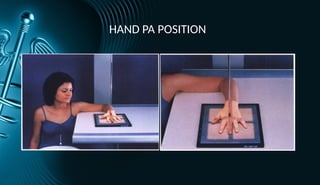 HAND X RAY SERIES bones human anatomy rtx | PPTX
