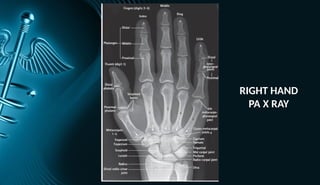 Profile Rx Hand HAND X RAY SERIES bones human anatomy rtx | PPTX