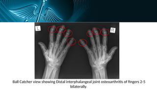 HAND X RAY SERIES bones human anatomy rtx | PPTX