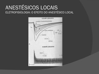 ANESTÉSICOS LOCAIS ELETROFISIOLOGIA: O EFEITO DO ANESTÉSICO LOCAL 