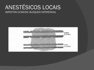 ANESTÉSICOS LOCAIS ASPECTOS CLÍNICOS: BLOQUEIO DIFERENCIAL 