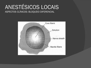 ANESTÉSICOS LOCAIS ASPECTOS CLÍNICOS: BLOQUEIO DIFERENCIAL 