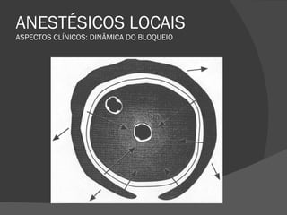 ANESTÉSICOS LOCAIS ASPECTOS CLÍNICOS: DINÂMICA DO BLOQUEIO 