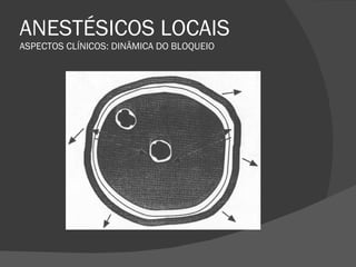 ANESTÉSICOS LOCAIS ASPECTOS CLÍNICOS: DINÂMICA DO BLOQUEIO 