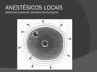 ANESTÉSICOS LOCAIS ASPECTOS CLÍNICOS: DINÂMICA DO BLOQUEIO 