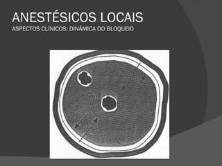 ANESTÉSICOS LOCAIS ASPECTOS CLÍNICOS: DINÂMICA DO BLOQUEIO 