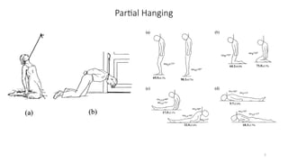 Hanging mechanism in forensic medicine-1 | PPTX