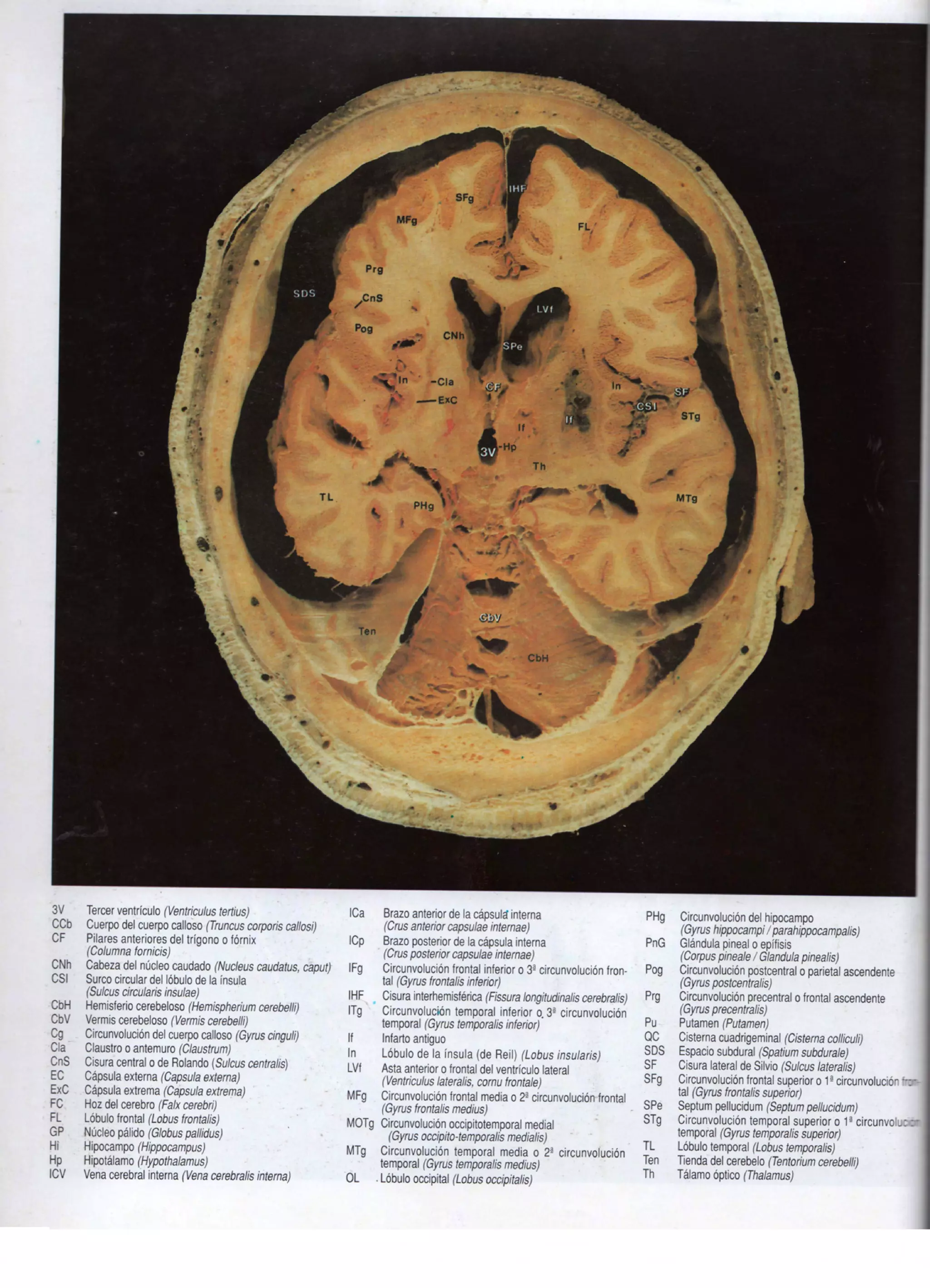 Han kim cortes anatomicos correlacionados con tac y rm - cabeza y ...