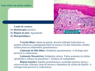 Caso clínico de clínica médica  Ac. Bruna Pimentel de Jesus Laudo de exames:  1)- Baciloscopia:  positivo. 2)- Biópsia de pele:  Aguardando. 3)- Histopatológico:  Vesícula Biliar:  edema de parede, discreto infiltrado linfocitário na gordura subserosa e impregnação biliar na mucosa. Os dois linfonodos isolados exibem processo inflamatório granulomatoso. Linfonodo de Hilo Biliar:  linfadenite granulomatosa. A etiologia mais provável é a tuberculose. Linfonodo Mesentérico:  linfadenite crônica. Vários acúmulos de células epitelióides ( esboços de granuloma ). Ausência de malignidade. Biópsia   hepática:  hepatite granulomatosa, acentuada esteatose macro e microvesicular, colestase, áreas de necrose e hiperplasia de células de Kupffer. A etiologia mais provável é a tuberculose. 