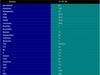 Exames de admissão: 11 / 03 / 09 Tabela 1 Caso clínico de clínica médica  Ac. Bruna Pimentel de Jesus Exames 11 / 03 / 09 Hematócrito 26 Hemáceas 2,88 Hemoglobina 8,5 VCM 90,27 HCM 29,51 CHCM 32,64 Leucócitos 2800 Basófilos 0 Eosinófilos 1 Bastões 19 Segmentados 64 Linfócitos 10 Monócitos 6 TAP 26’’/29 % PTT 49 Na 137 K 4,0 Glicose 73 Uréia 25 Creatinina 0,7 TGO 113 TGP 43 FA 1360 GGT 365 