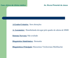 Caso clínico de clínica médica  Ac. Bruna Pimentel de Jesus A.Genito-Urinário:   Sem alterações A. Locomotor:   Deambulando devagar pelo quadro de edema de MMII Sistema Nervoso:  Não avaliado Diagnóstico Sindrômico:   Dermatite Diagnósticos Principais :  Hanseníase Virchowiana Multibacilar 